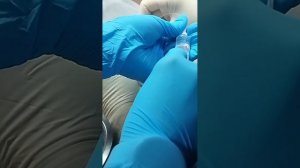 Острая задержка мочи😿