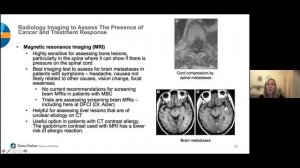 Biomarkers for Treatment and Progression | 2021-2022 EMBRACE MBC Virtual Forum Series