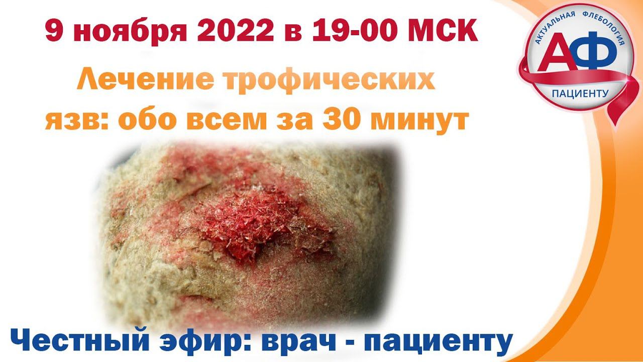 Лечение венозных трофических язв Коротко за 30 мин для пациентов смотреть онлайн