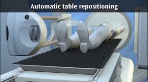 Лечение с использованием линейного ускорителя Elekta Synergy®