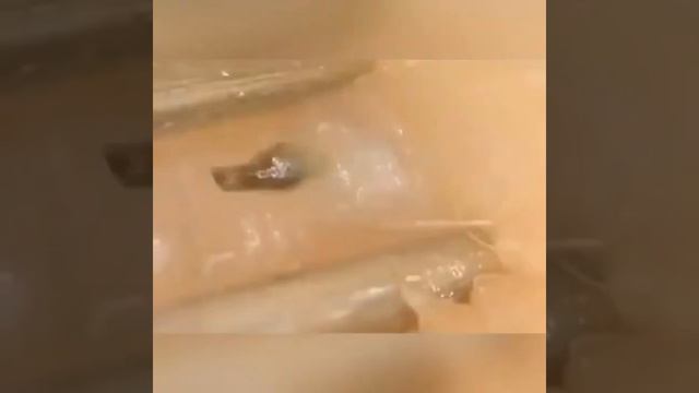 Чёрные точки | Blackheads | Чистка Кожи смотреть онлайн