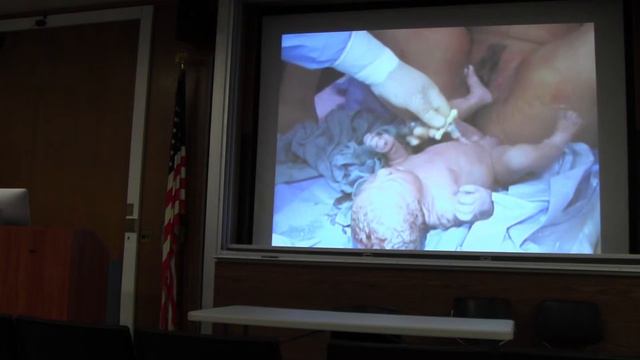 Dr. Schecter: Obstetrics in the ED Part 1 смотреть онлайн