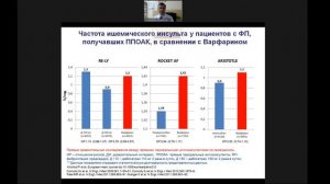 Разбор клинического случая пациента с инсультом и с тромбом ушка левого предсердия.