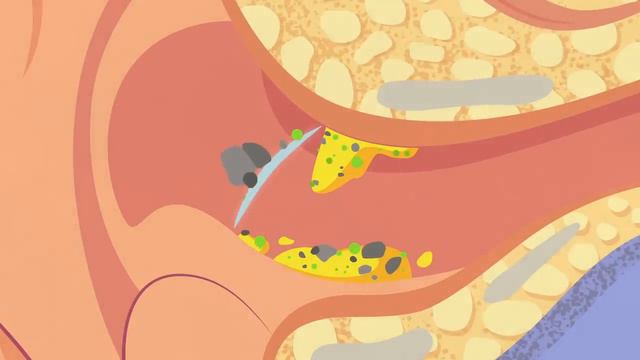 What is earwax — and should you get rid of it - Henry C. Ou.mp4 смотреть онлайн