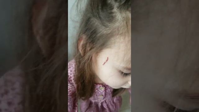 9 упражнений для школьников | При ДЦП смотреть онлайн