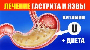 Гастрит и Язва Желудка. Лечение Профилактика Диета