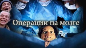 С. Савельев. Операции на мозге.mp4