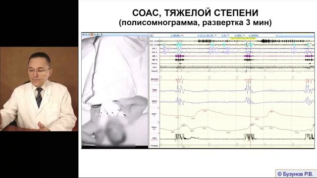 Первый Национальный Конгресс респираторной медицины: День II; Зал I смотреть онлайн