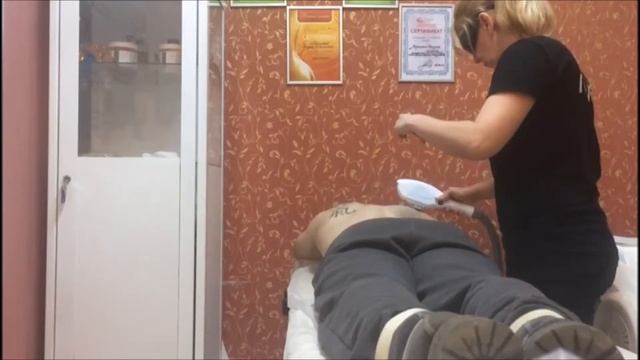 Элос эпиляция. Демонстрация проведения процедуры элос на спине