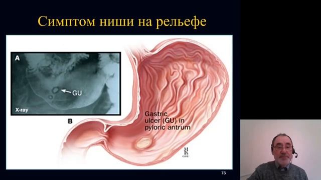 Лучевая диагностика 5. Лучевая диагностика желудочно кишечного тракта смотреть онлайн
