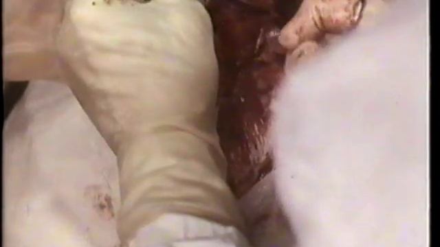 Кесарево сечение © Сesarian section смотреть онлайн