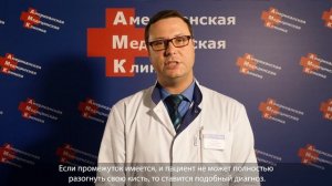 Контрактура Дюпюитрена