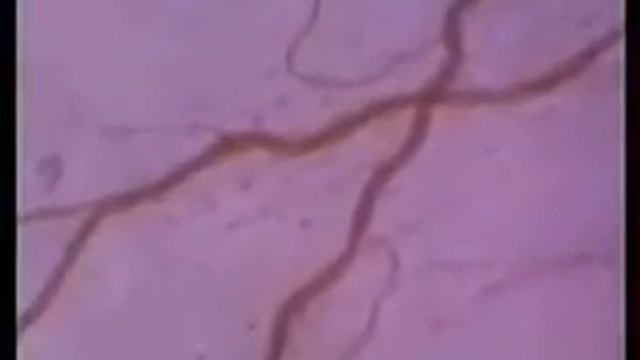 Строение и функции эритроцитов