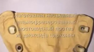 Полная адентия нижней челюсти (отсутствие зубов)