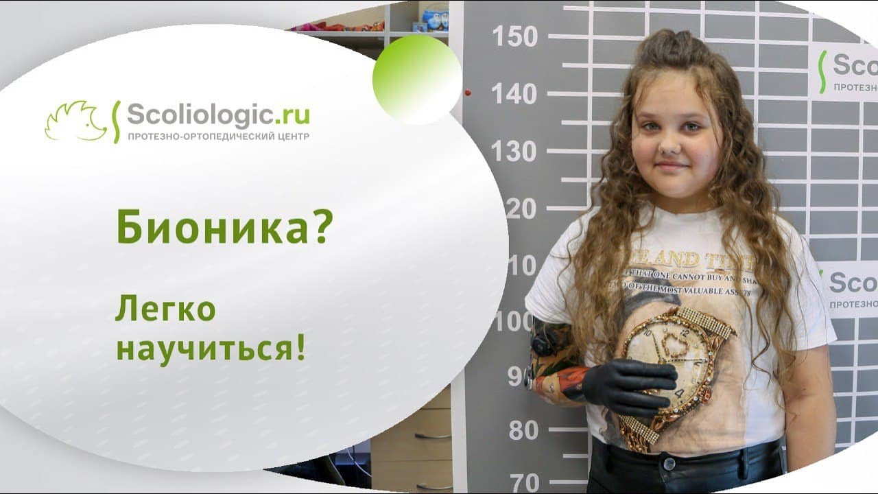 Как научиться пользоваться бионическим протезом плеча