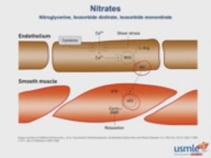 USMLE RX - 2.Кардиология - 4.Фармакология - 14.Нитраты