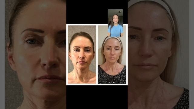 Здоровая и молодая шея - залог красоты лица