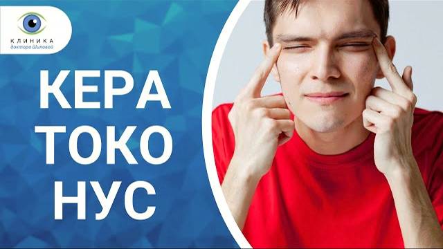 Возраст появления кератоконуса и симптомы заболевания смотреть онлайн