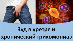 Зуд в уретре и хронический трихомониаз