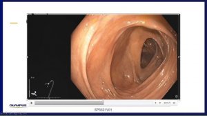 Improving Procedural Awareness Utilizing ScopeGuide