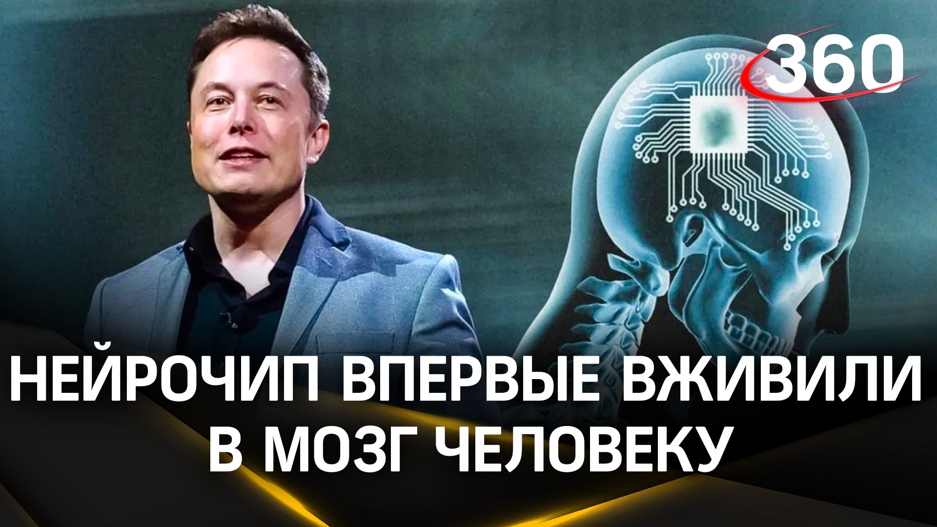 Нейрочип впервые вживили в мозг человеку в компании Илона Маска. Добровольцем стал инвалид