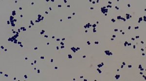 Gram positive cocci in singles, pairs and terads of Micrococcus under the Microscope