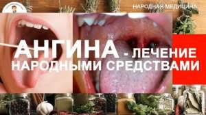 Ангина это вирусное или бактериальное заболевание