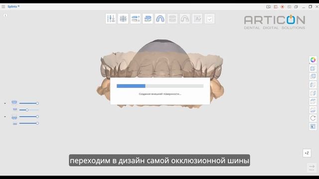 СОЗДАНИЕ СПЛИНТОВ В НОВОМ МОДУЛЕ MEDIT LINK ДЛЯ ИНТРАОРАЛЬНЫХ СКАНЕРОВ MEDIT | ARTICON