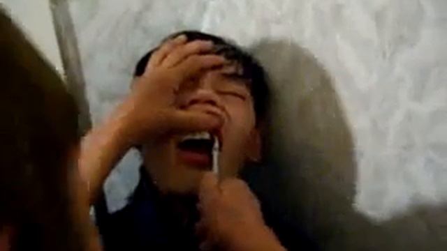 саха удаления зуба смотреть онлайн