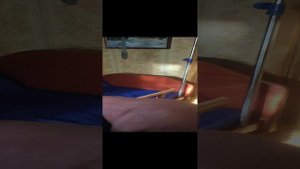 медицинская кровать db11a