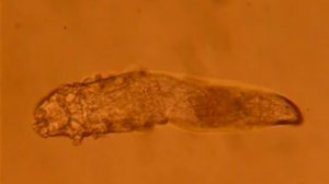 Подкожный клещ демодекс видео под микроскопом