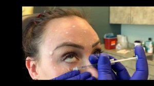 Botox full face training video