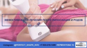 "KANDILUX studio" Вакуумно-роликовый массаж V8-shape