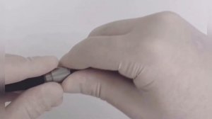 Удаление геморроя Лигирование латексными кольцами