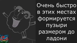 Синдром Стивенса - Джонсона .. Это очень опасно ..
