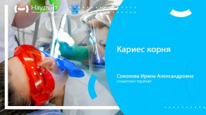 Кариес корня зуба
