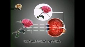 Все про зрение как подбирают очки