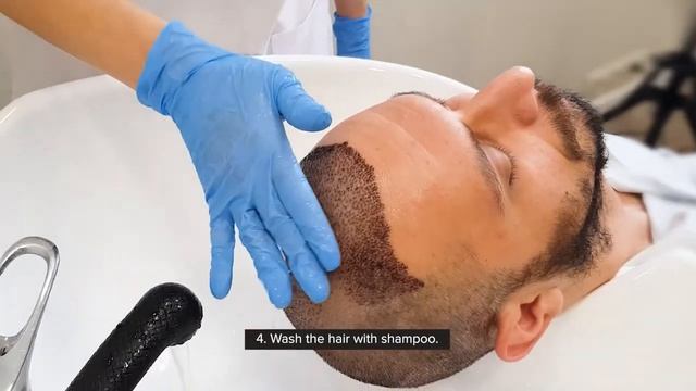 How to wash your hair after hair transplant? | Antalya | DK Klinik смотреть онлайн