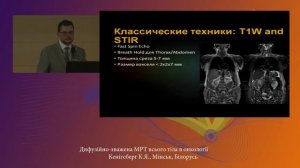 02 Дифузійно зважена МРТ всього тіла в онкології Кенігсберг К Я , Мінськ, Білорусь