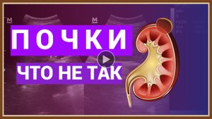 ПОЧКИ - ЧТО НЕ ТАК.mp4