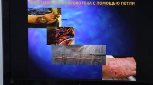 Зав.отделением сосудистой хирургии Дорожной клинической больницы ОАО "РЖД" И. Сонькин