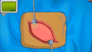 Operate Now: Appendix Surgery - walkthrough