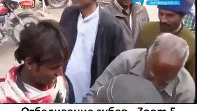 Отбеливание зубов - Zoom 5