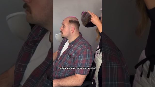 Мужская система волос