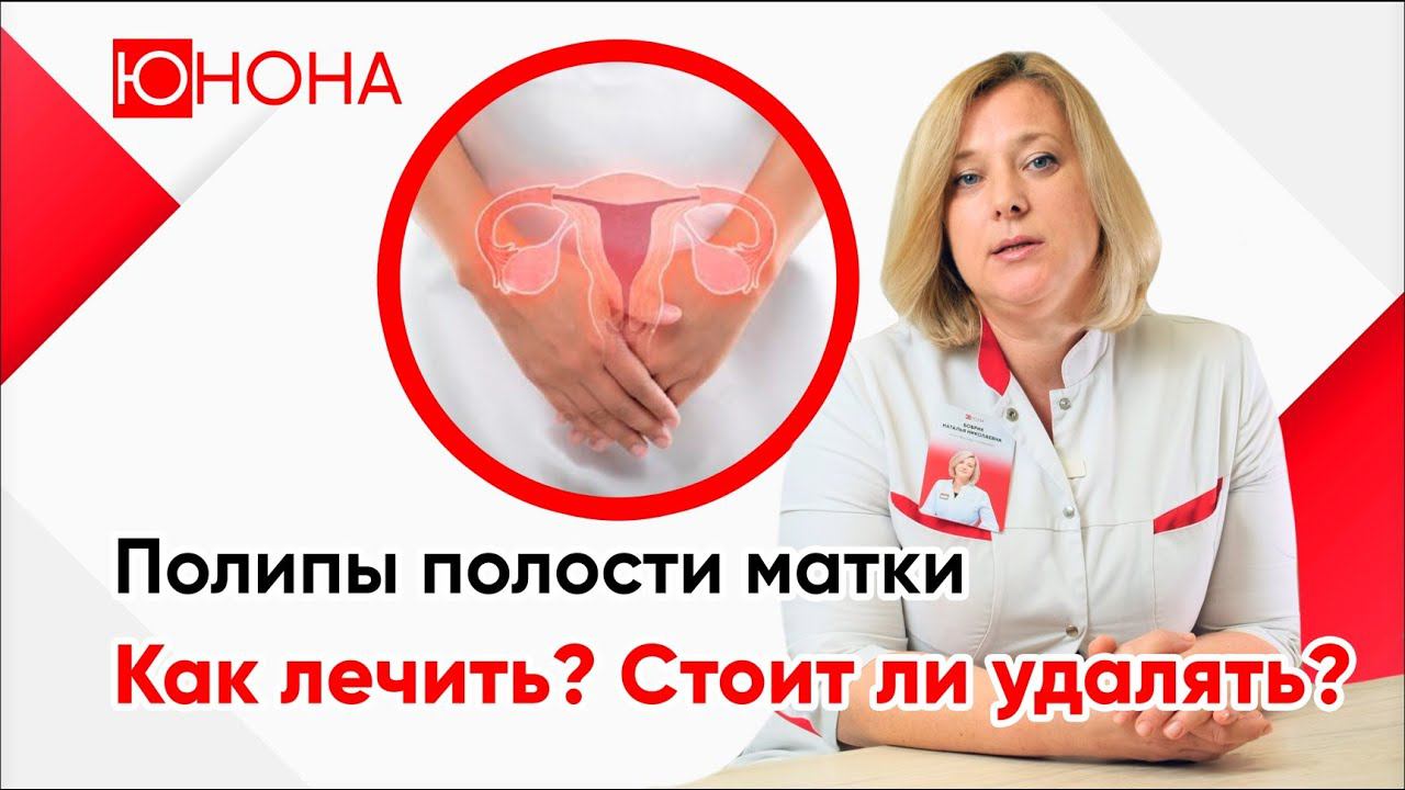 Полипы полости матки. Как лечить? Стоит ли удалять полипы?