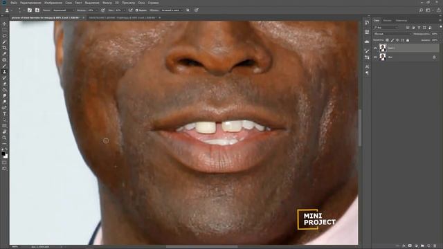 how to remove facial scars/ Seal/ extreme makeover in photoshop /удаление шрамов на лице в фотошопе смотреть онлайн