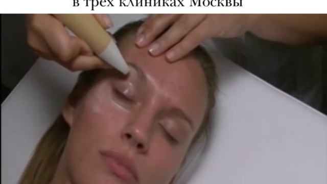 Морщины вокруг глаз. RF -лифтинг смотреть онлайн