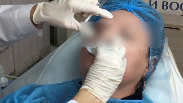 Femegyl применение на практике смотреть онлайн