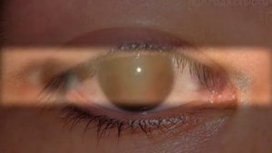 ПЕРМАНЕНТНЫЙ МАКИЯЖ СТРЕЛКИ ФОТО ДО И ПОСЛЕ