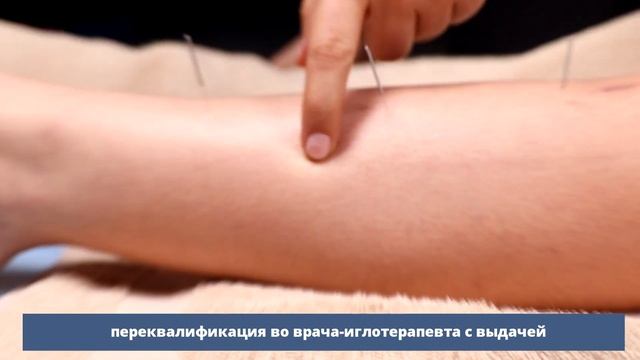 Как обучиться рефлексотерапии? Очные практические занятия в Академии акупунктуры Акумед.